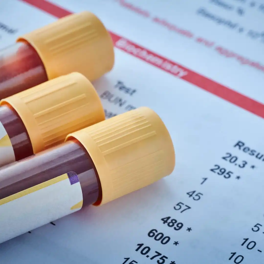 Genética e Exames Laboratoriais