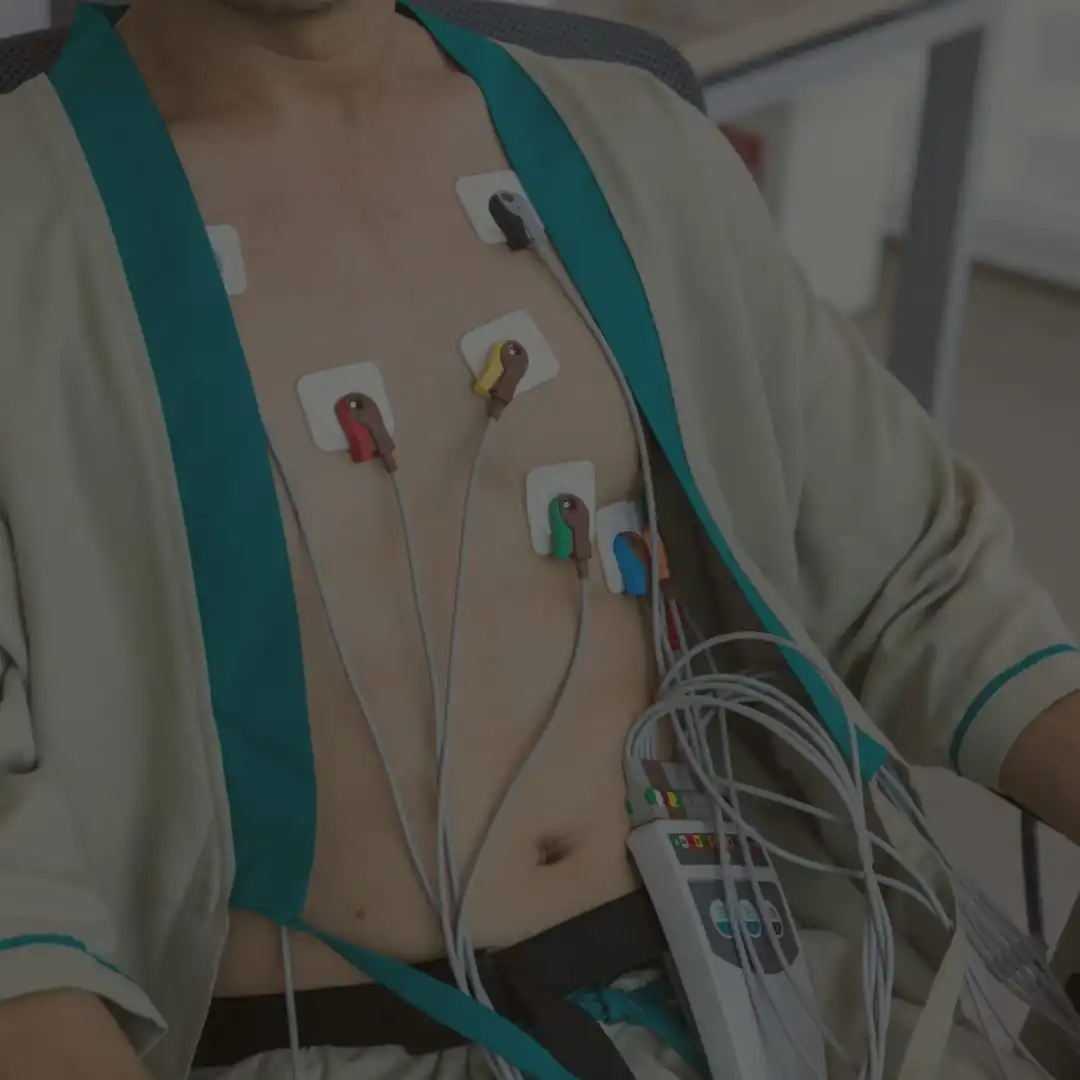 Eletrocardiograma (ECG)