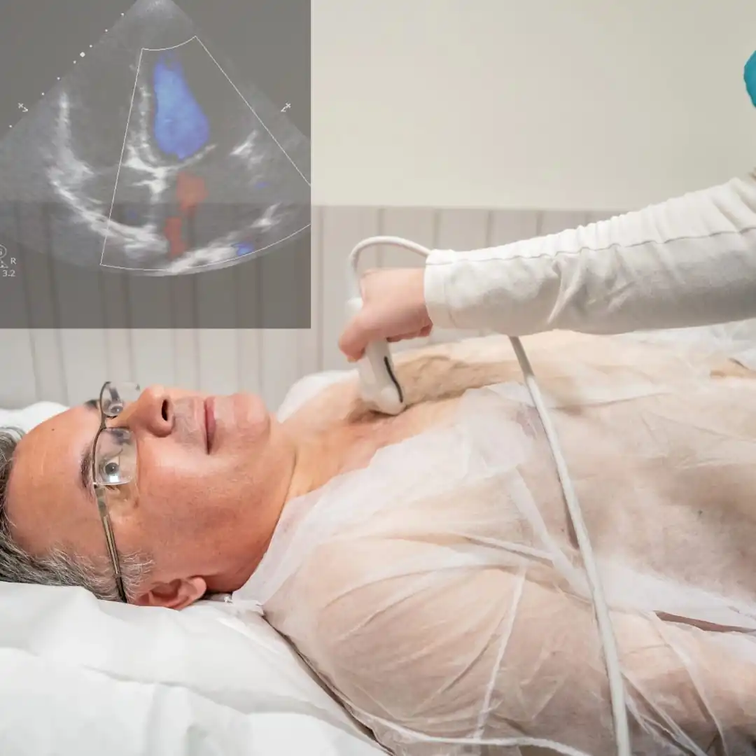 Ecocardiograma transtorácico com Strain cardíaco